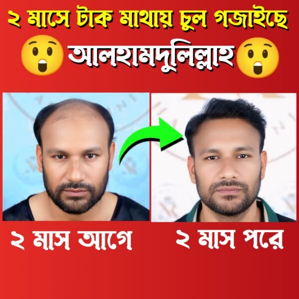 হেয়ার কম্বো - Image 3