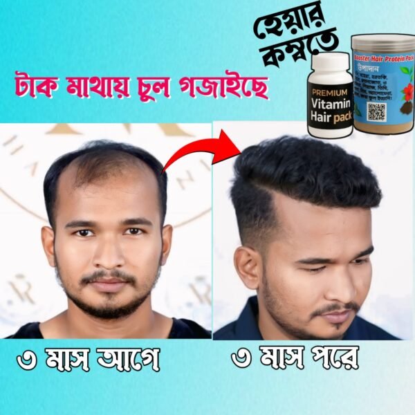 হেয়ার কম্বো - Image 6